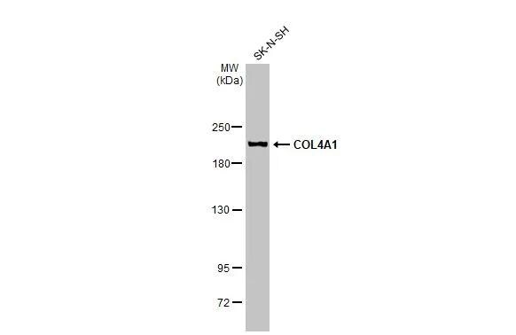 Collagen IV alpha 1 Antibody