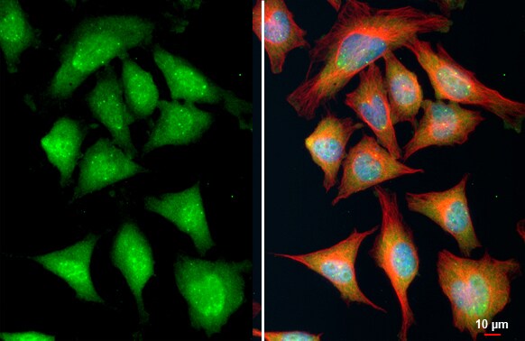 PTEN [p Thr366, p Ser370] Antibody