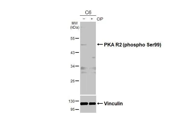 PKA R2 [p Ser99] Antibody
