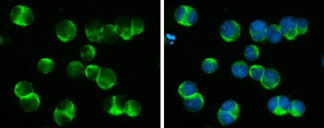 DOCK2 Antibody