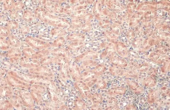 LASS2 Antibody