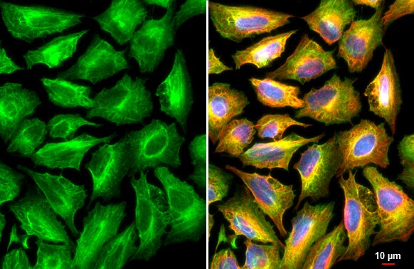 Plectin Antibody
