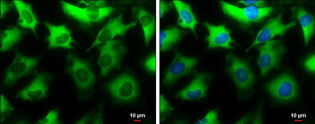 NMT1 Antibody