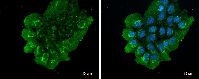 Nesfatin-1/Nucleobindin-2 Antibody - BSA Free