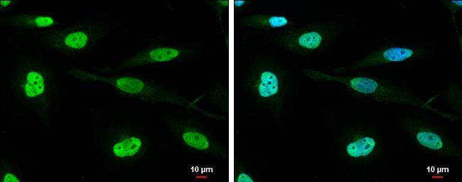 RNA Helicase A Antibody