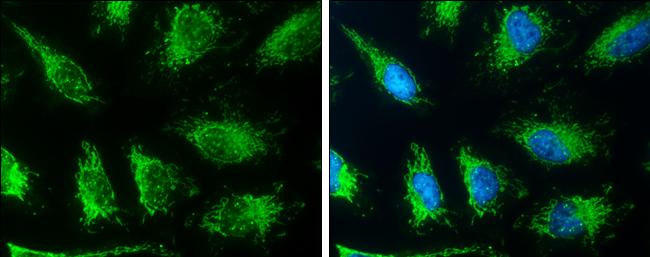 SLC19A2 Antibody - BSA Free
