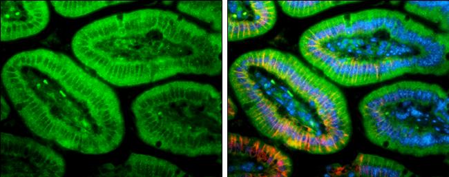 PLEKHA7 Antibody - BSA Free