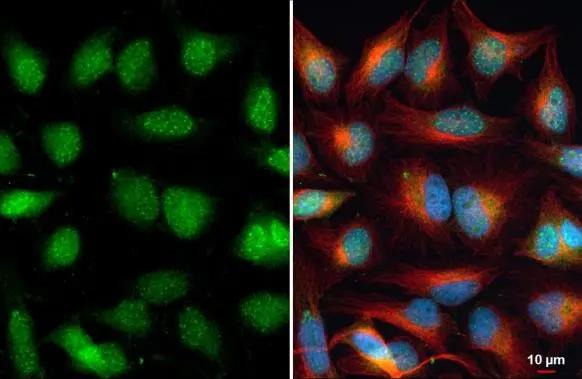 ARID5B Antibody - BSA Free