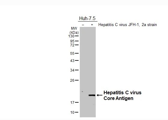 Hepatitis C Virus Core Antigen Antibody - BSA Free