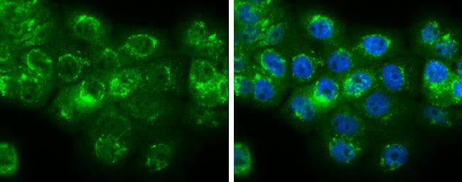 Neuromedin-U Antibody - BSA Free