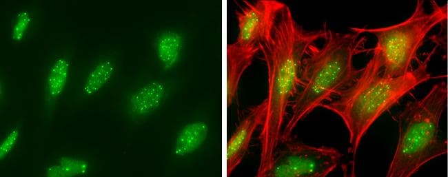 SP100 Antibody - BSA Free