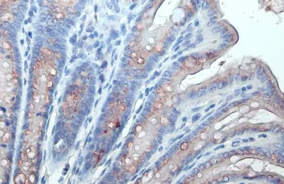 Polypeptide GalNac Transferase 3/GALNT3 Antibody