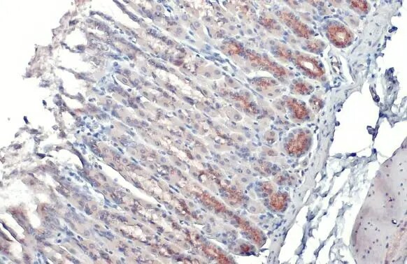 Polypeptide GalNac Transferase 3/GALNT3 Antibody