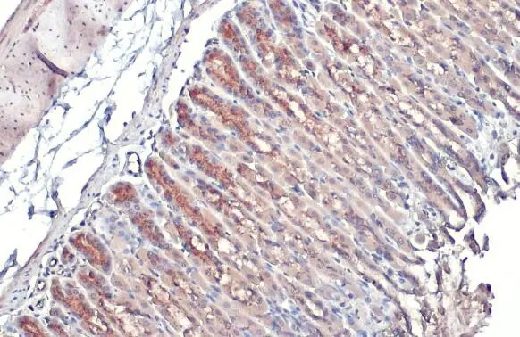 Polypeptide GalNac Transferase 3/GALNT3 Antibody