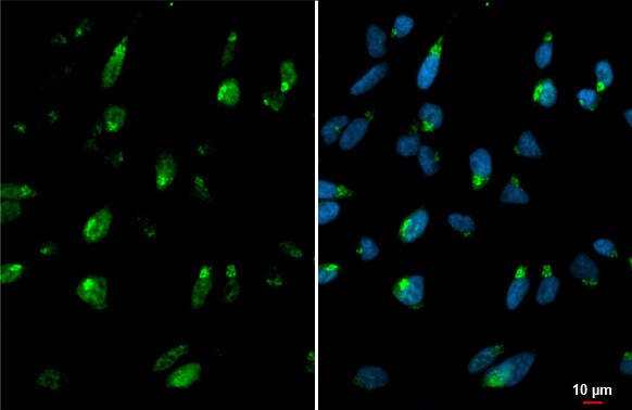 Polypeptide GalNac Transferase 3/GALNT3 Antibody