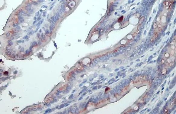Polypeptide GalNac Transferase 3/GALNT3 Antibody