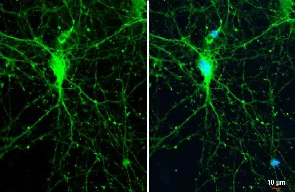SynGAP Antibody - BSA Free
