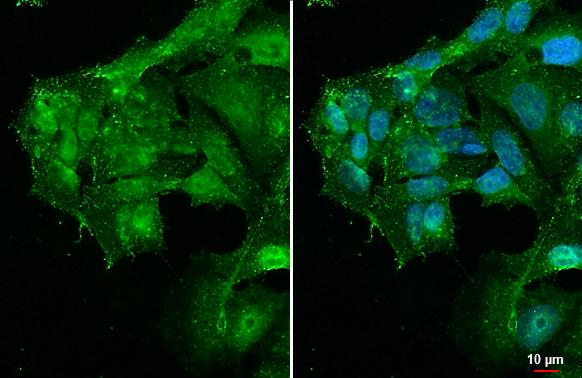 PARP14 Antibody - BSA Free
