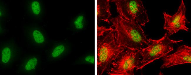 DNA Polymerase epsilon catalytic subunit A Antibody