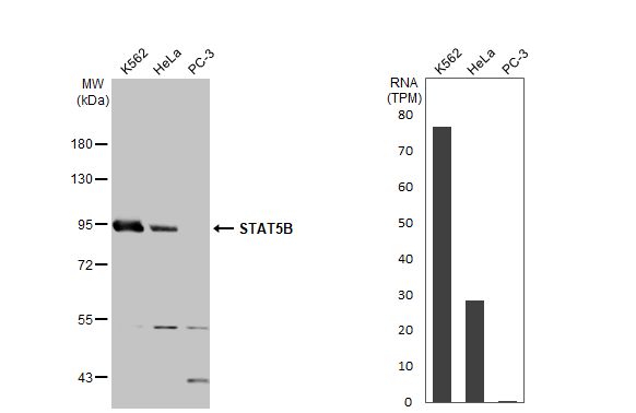 STAT5b Antibody