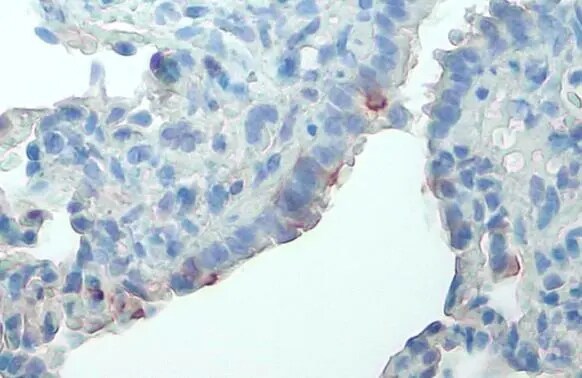 FAK [p Tyr576] Antibody