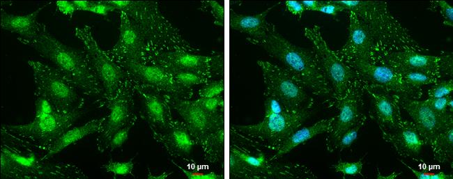 FAK [p Tyr576] Antibody