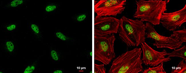 Rad17 [p Ser656] Antibody