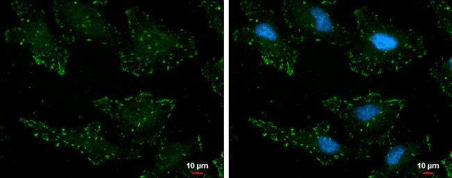 p130Cas/BCAR1 [p Tyr165] Antibody