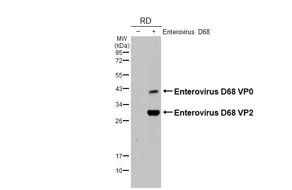 Enterovirus D68 VP2 Antibody - BSA Free