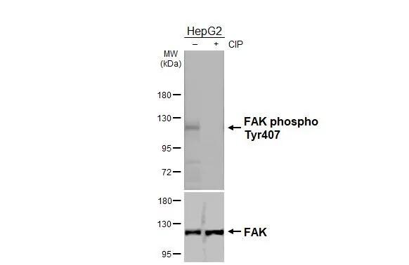 FAK [p Tyr407] Antibody