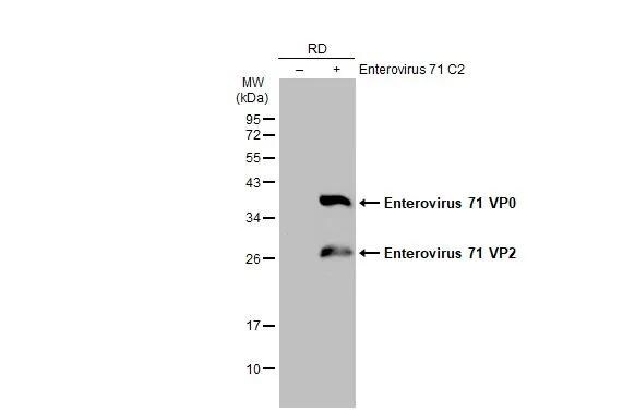 Enterovirus 71 VP2 Antibody - BSA Free