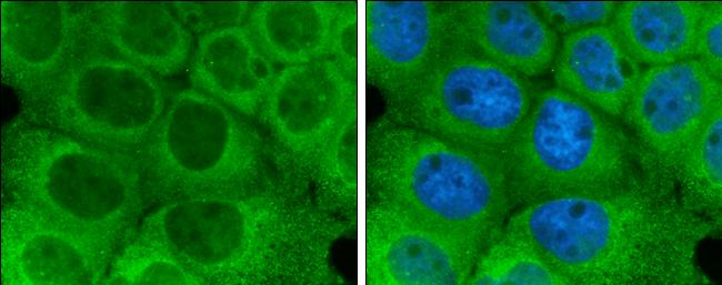 Optineurin Antibody - BSA Free