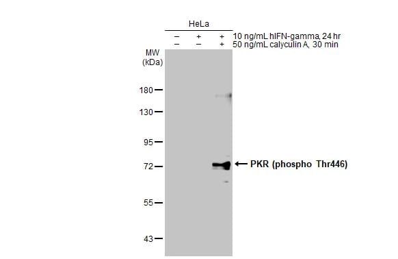 PKR [p Thr446] Antibody