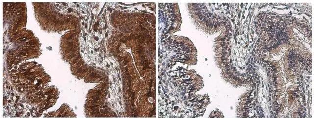 TOR/mTOR [p Ser2448] Antibody