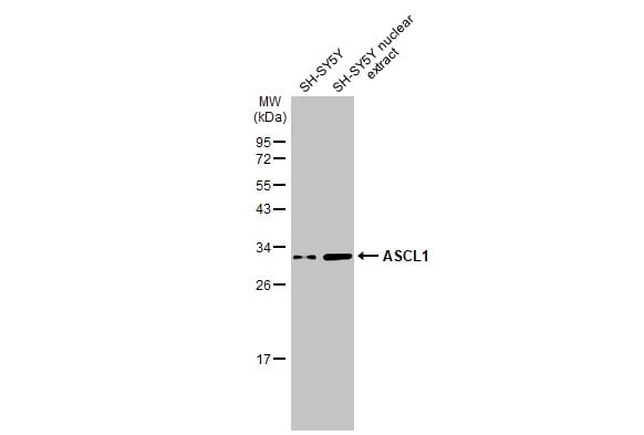ASCL1/Mash1 Antibody