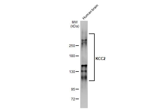 KCC2/SLC12A5 Antibody