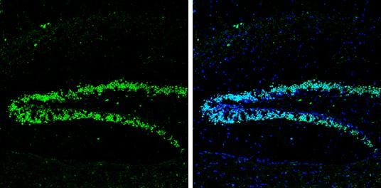 Neuropeptide Y Antibody - BSA Free