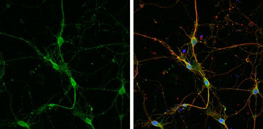 GAT-1/SLC6A1 Antibody - BSA Free