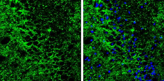 GAT-1/SLC6A1 Antibody - BSA Free