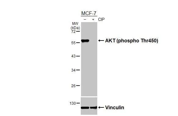 AKT [p Thr450] Antibody