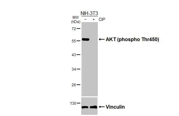 AKT [p Thr450] Antibody