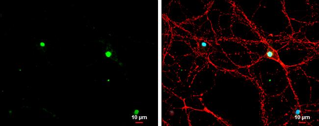 TBR1 Antibody