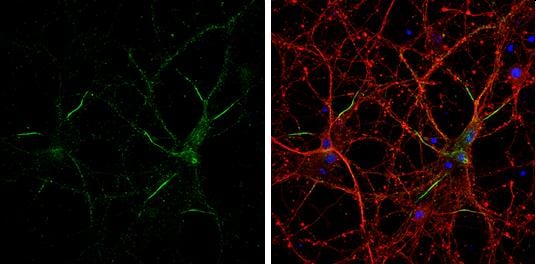 Neurofascin Antibody