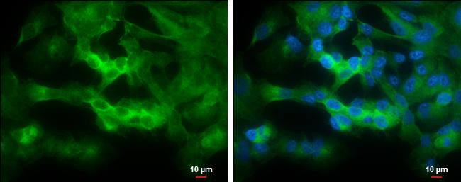 STRN4 Antibody