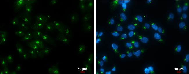 RAP1GAP Antibody