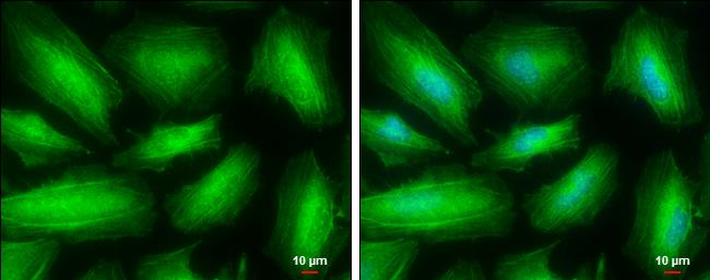 non-muscle heavy chain 10 Myosin Antibody - BSA Free