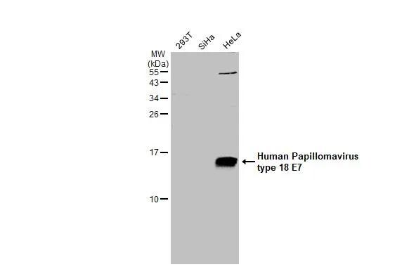 HPV18 E7 Antibody - BSA Free