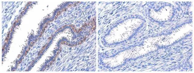 ErbB2/Her2 [p Tyr1222, p Tyr1221] Antibody