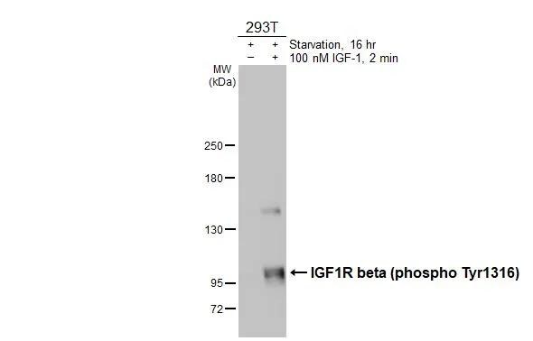 IGF-I R/IGF1R [p Tyr1316] Antibody