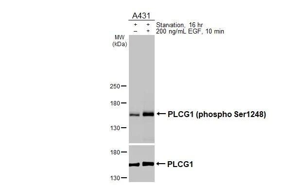 PLC-gamma 1 [p Ser1248] Antibody